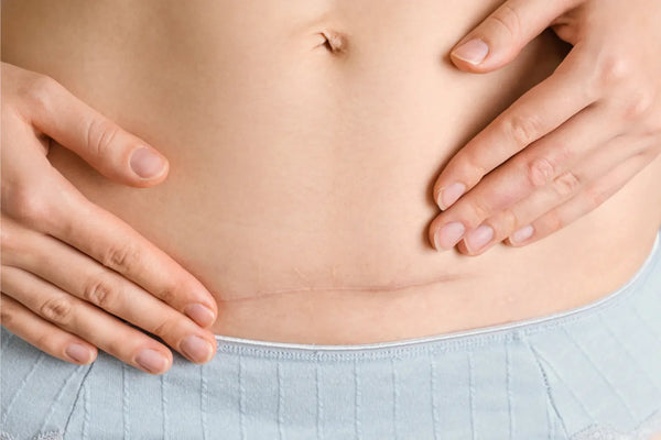 Doctor explaining C-section indications and risks to a pregnant patient