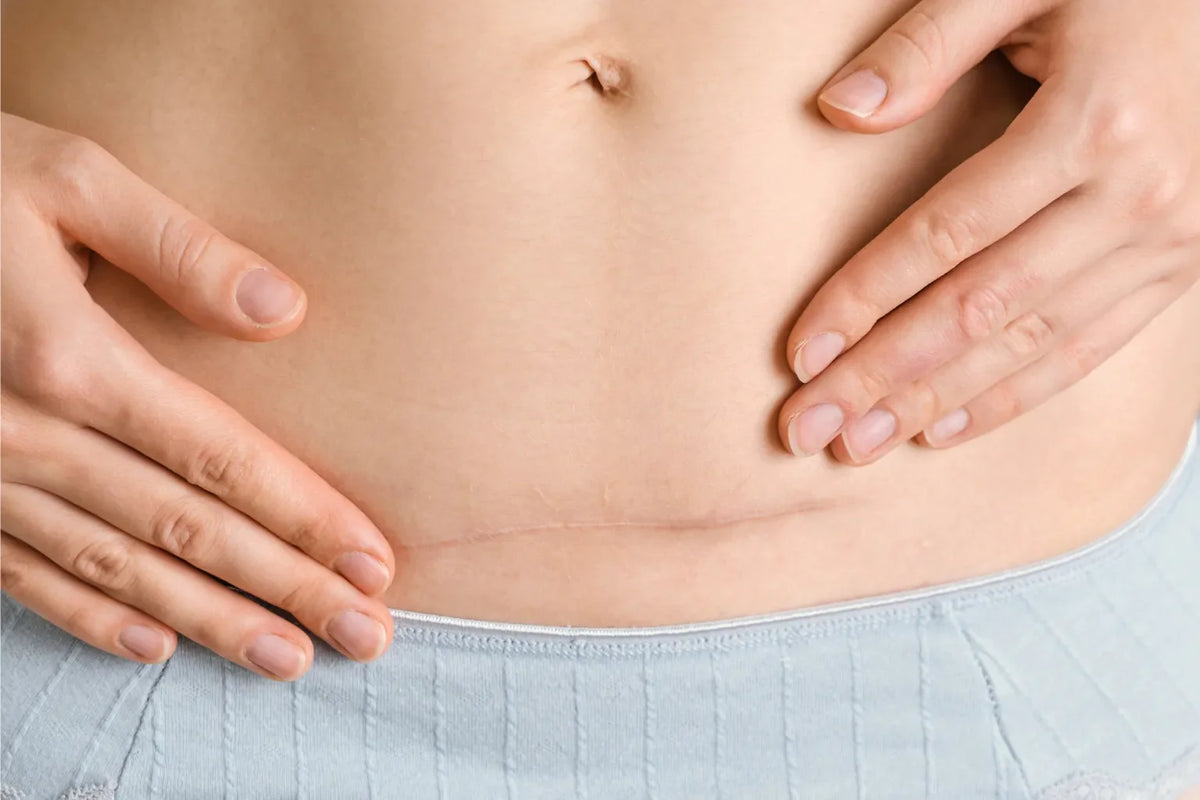 Doctor explaining C-section indications and risks to a pregnant patient